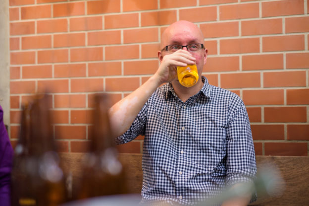 A bebida alcoólica causa queda de cabelo?