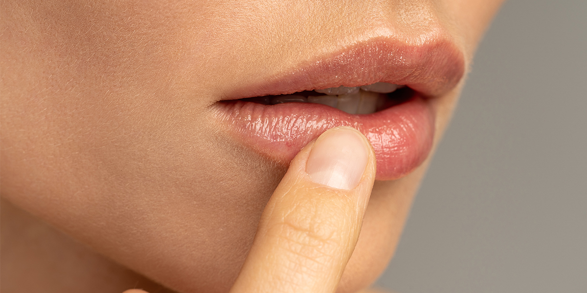 Lábios Ressecados: dicas úteis para tratar - Dr. Lucas Fustinoni